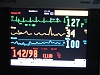 Cardiac monitor