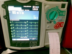 Defibrillator with 12 lead ECG and AED mode