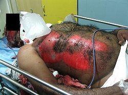 photo of a trauma victim