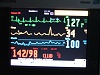 Cardiac monitor